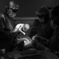 fotografia-de-parto-brasilia-cesarea