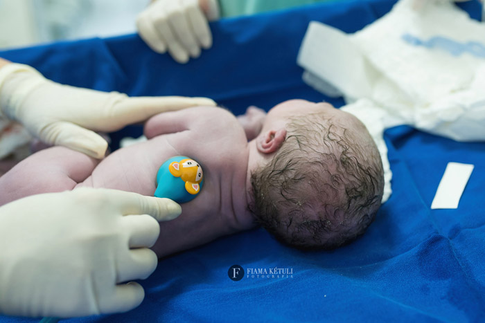 Primeiros exames no bebê recém nascido