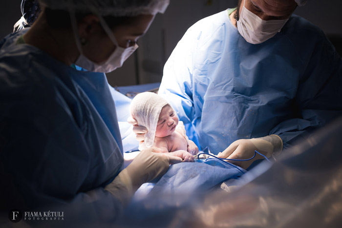 Registro de nascimento em um parto cesárea