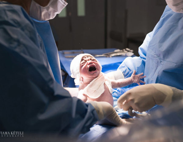 Primeiro choro bebê - fotografia de parto